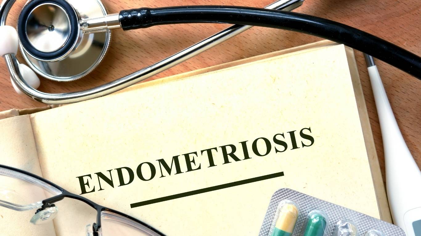Endometriozis ve çikolata kisti beslenmesinde dengeli ve anti-inflamatuar tabak düzeni